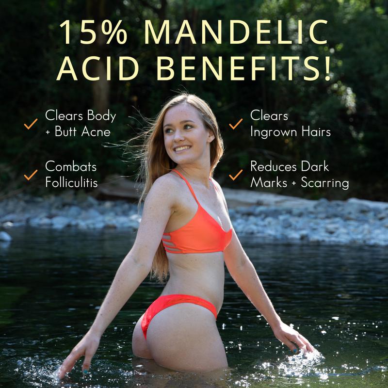 Body Magic Serum (15% Mandelic Acid)