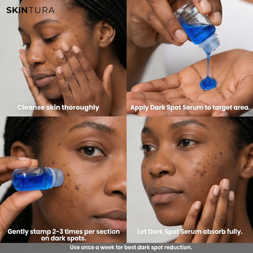 Skintura - Glass Skin Micro Infusion System