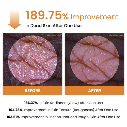 Peel Shot Exfoliating Kojic Acid Turmeric Spray