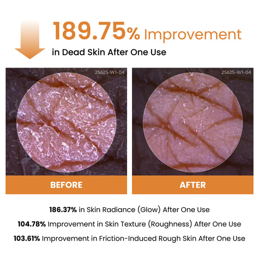 Peel Shot Exfoliating Kojic Acid Turmeric Spray