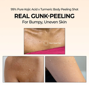 Peel Shot Exfoliating Kojic Acid Turmeric Spray