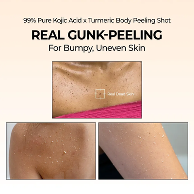 Peel Shot Exfoliating Kojic Acid Turmeric Spray