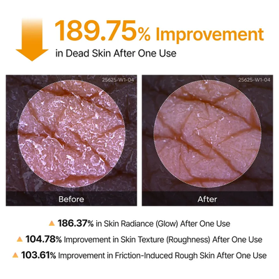 Peel Shot Exfoliating Kojic Acid Turmeric Spray