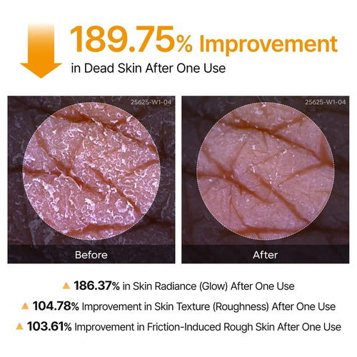 Peel Shot Exfoliating Kojic Acid Turmeric Spray